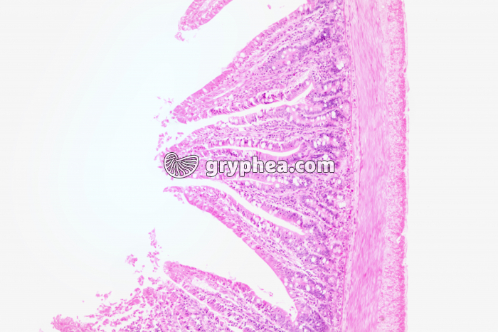 Valvule connivente x25 - gryphea.org